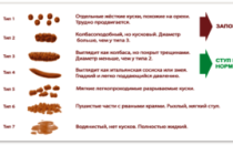 лентовидный стул